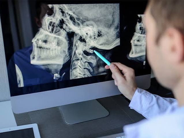 Understanding X-rays: Types, Uses, and What They Show